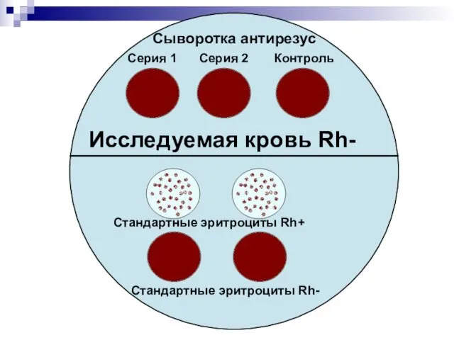 Сыворотка антирезус Серия 1 Серия 2 Контроль Стандартные эритроциты Rh+ Стандартные эритроциты Rh- Исследуемая кровь Rh-