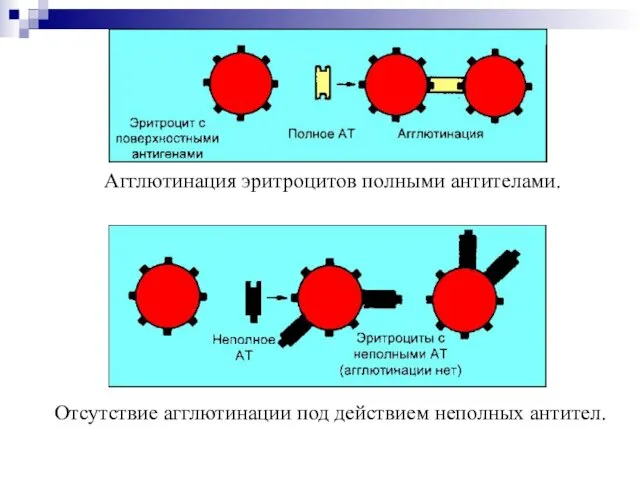 Агглютинация эритроцитов полными антителами. Отсутствие агглютинации под действием неполных антител.