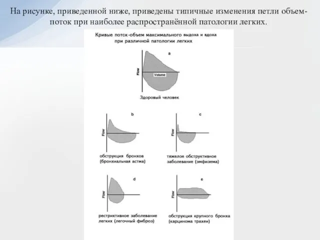 На рисунке, приведенной ниже, приведены типичные изменения петли объем-поток при наиболее распространённой патологии легких.