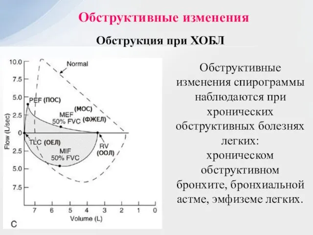 Обструктивные изменения Обструкция при ХОБЛ Обструктивные изменения спирограммы наблюдаются при хронических