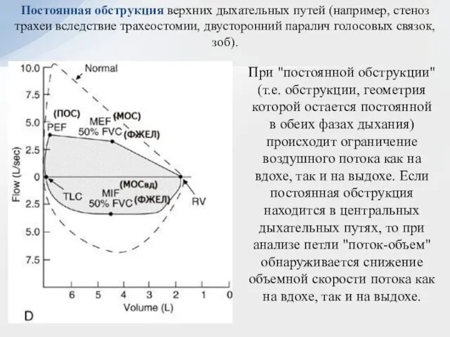 Постоянная обструкция верхних дыхательных путей (например, стеноз трахеи вследствие трахеостомии, двусторонний