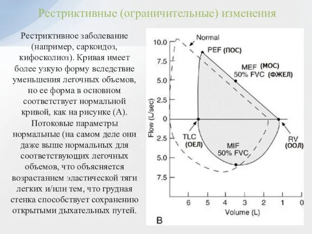 Рестриктивные (ограничительные) изменения Рестриктивное заболевание (например, саркоидоз, кифосколиоз). Кривая имеет более