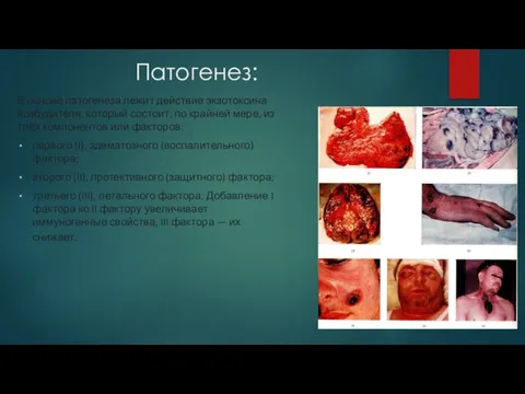 Патогенез: В основе патогенеза лежит действие экзотоксина возбудителя, который состоит, по