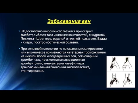 Заболевания вен ЭХ достаточно широко используется при острых флеботромбозах таза и