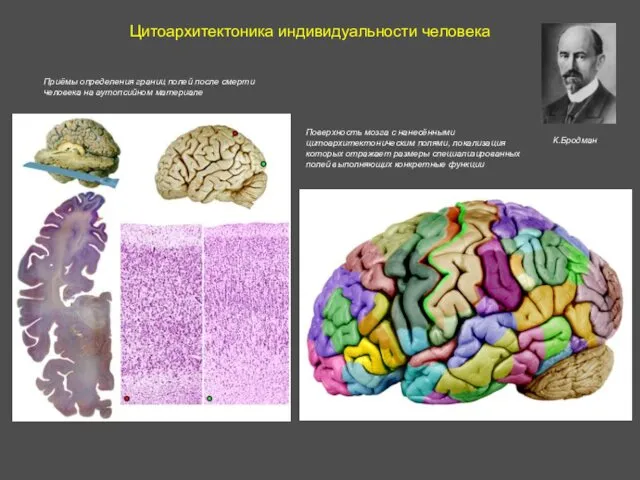 Цитоархитектоника индивидуальности человека Поверхность мозга с нанесёнными цитоархитектоническим полями, локализация которых