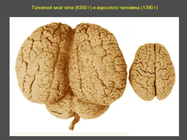 Головной мозг кита (6300 г) и взрослого человека (1390 г)