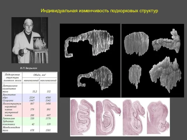 Индивидуальная изменчивость подкорковых структур В.П.Зворыкин