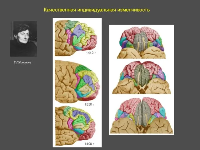 Качественная индивидуальная изменчивость 1440 г 1400 г 1550 г Е.П.Кононова