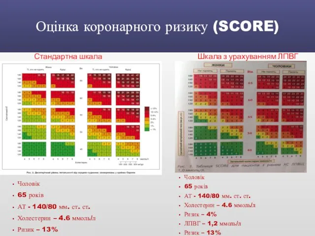 Оцінка коронарного ризику (SCORE) Чоловік 65 років АТ - 140/80 мм.