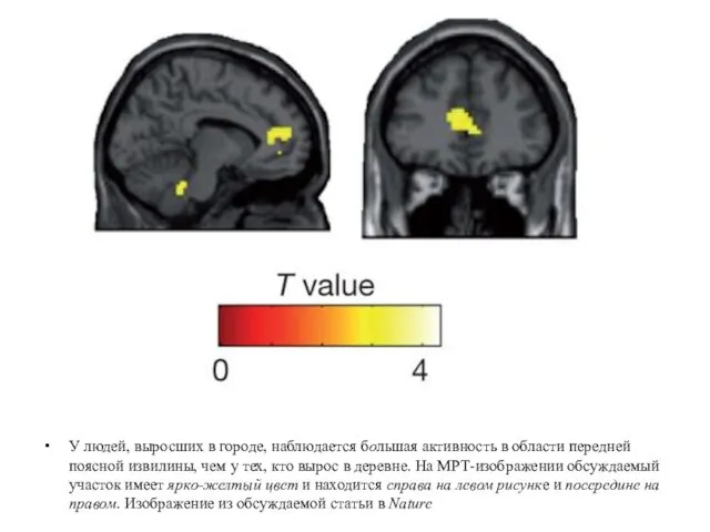У людей, выросших в городе, наблюдается большая активность в области передней