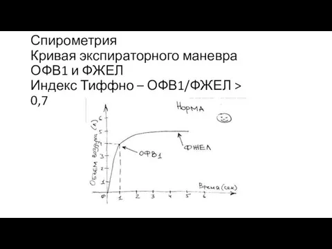 Спирометрия Кривая экспираторного маневра ОФВ1 и ФЖЕЛ Индекс Тиффно – ОФВ1/ФЖЕЛ > 0,7