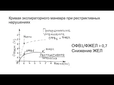 Кривая экспираторного маневра при рестриктивных нарушениях ОФВ1/ФЖЕЛ > 0,7 Снижение ЖЕЛ