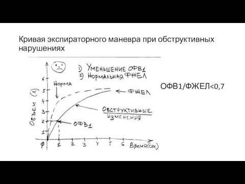 Кривая экспираторного маневра при обструктивных нарушениях ОФВ1/ФЖЕЛ