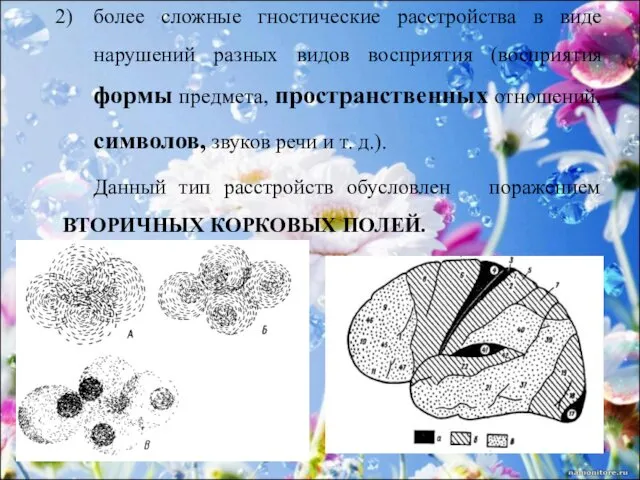 более сложные гностические расстройства в виде нарушений разных видов восприятия (восприятия