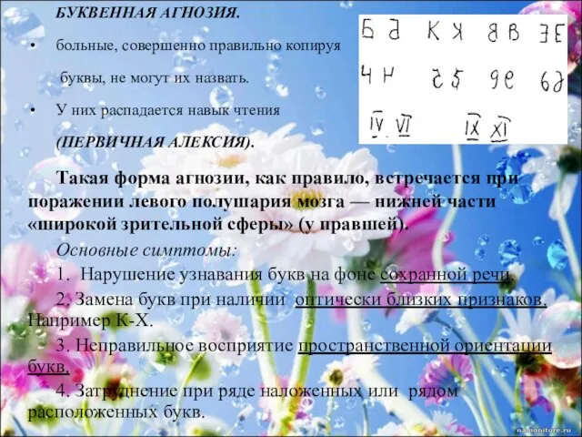 БУКВЕННАЯ АГНОЗИЯ. больные, совершенно правильно копируя буквы, не могут их назвать.