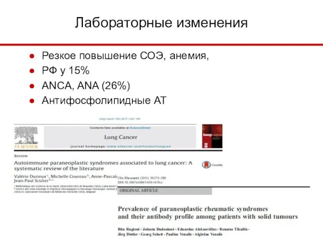 Лабораторные изменения Резкое повышение СОЭ, анемия, РФ у 15% ANCA, ANA (26%) Aнтифосфолипидные АТ