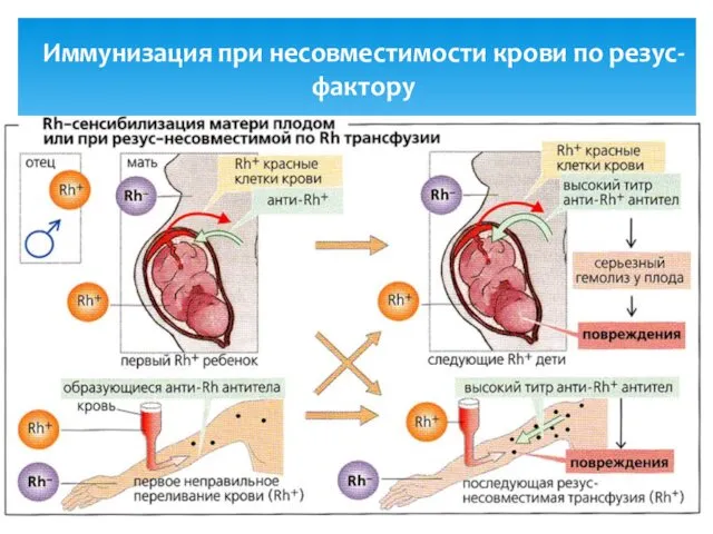 Иммунизация при несовместимости крови по резус-фактору