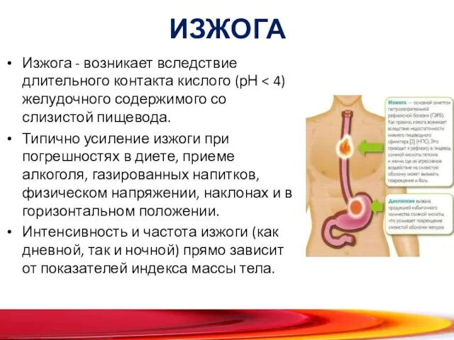 ИЗЖОГА Изжога - возникает вследствие длительного контакта кислого (рН Типично усиление