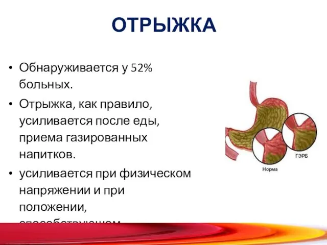 ОТРЫЖКА Обнаруживается у 52% больных. Отрыжка, как правило, усиливается после еды,