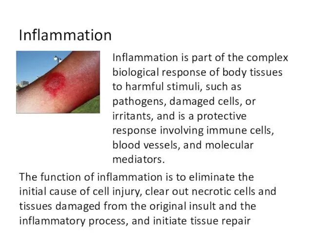 Inflammation Inflammation is part of the complex biological response of body