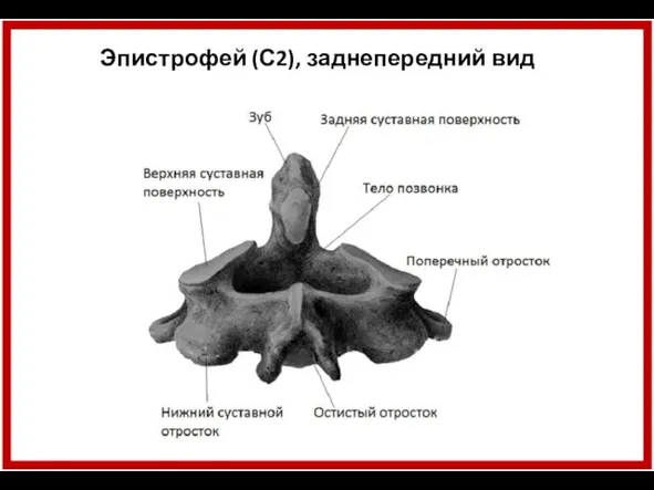 Эпистрофей (С2), заднепередний вид