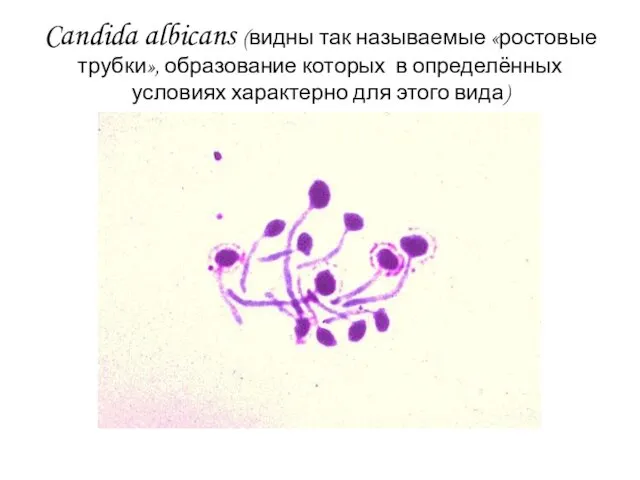 Candida albicans (видны так называемые «ростовые трубки», образование которых в определённых условиях характерно для этого вида)