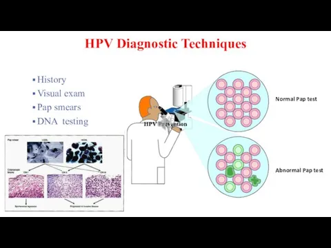 HPV Diagnostic Techniques History Visual exam Pap smears DNA testing Normal