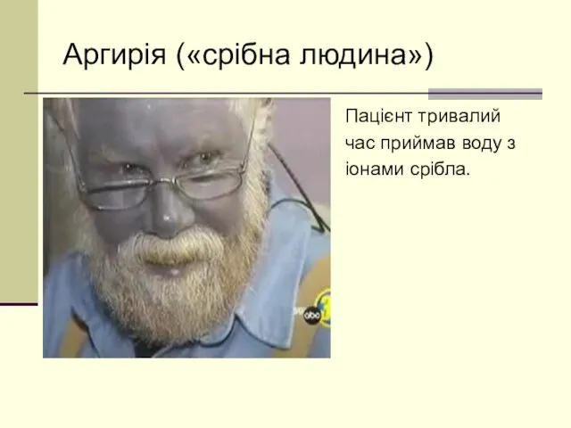 Аргирія («срібна людина») Пацієнт тривалий час приймав воду з іонами срібла.