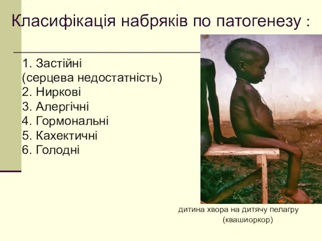 Класифікація набряків по патогенезу : 1. Застійні (серцева недостатність) 2. Ниркові