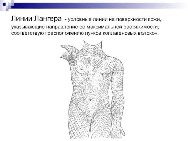 Линии Лангера - условные линии на поверхности кожи, указывающие направление ее