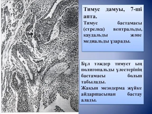 Тимус дамуы, 7-ші апта. Тимус бастамасы (стрелка) вентральды, каудальды және медиальды