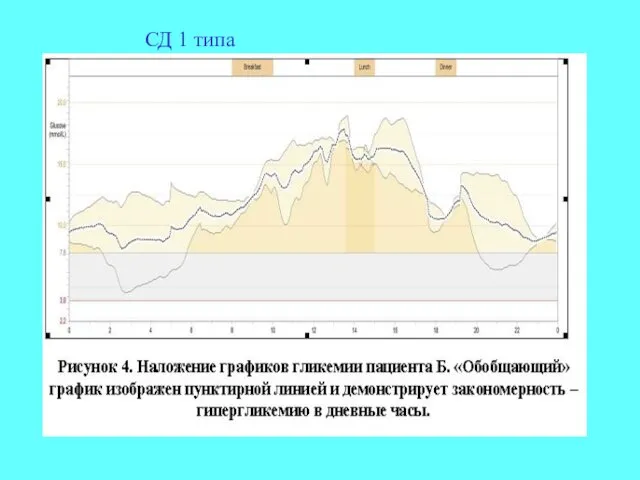 СД 1 типа