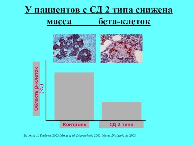 У пациентов с СД 2 типа снижена масса бета-клеток Butler et