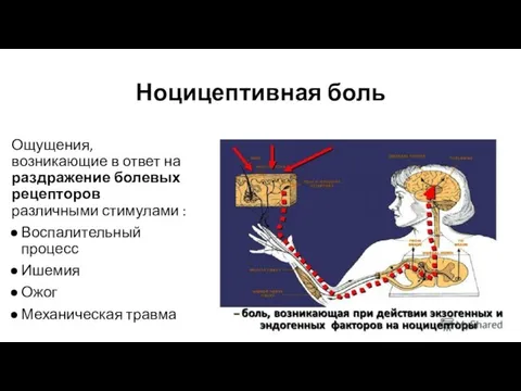 Ноцицептивная боль Ощущения, возникающие в ответ на раздражение болевых рецепторов различными