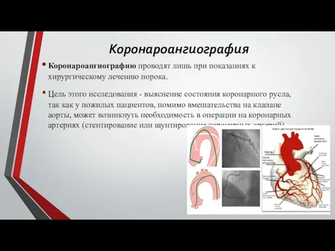 Коронароангиография Коронароангиографию проводят лишь при показаниях к хирургическому лечению порока. Цель