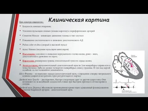 Клиническая картина При осмотре пациентов : Бледность кожных покровов; Усиление пульсации