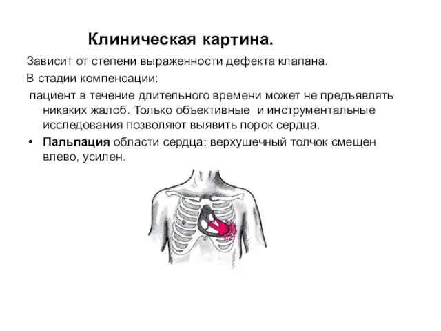 Клиническая картина. Зависит от степени выраженности дефекта клапана. В стадии компенсации: