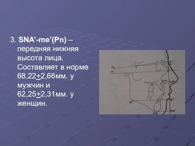 3. SNA’-me’(Pn) – передняя нижняя высота лица. Составляет в норме 68,22+2,66мм.