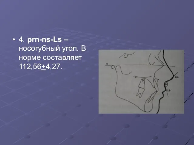 4. prn-ns-Ls – носогубный угол. В норме составляет 112,56+4,27.