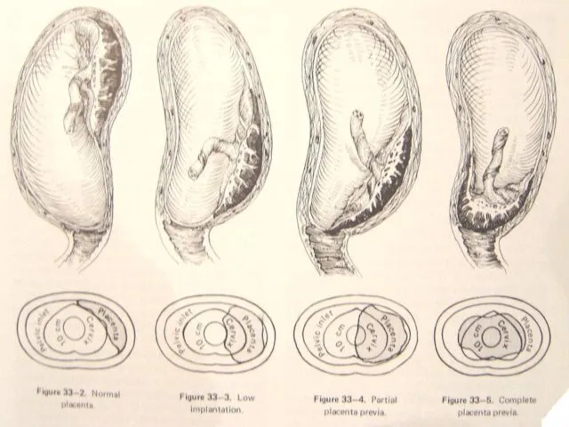 classification