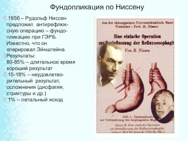 1956 – Рудольф Ниссен предложил антирефлюк-сную операцию – фундо-пликацию при ГЭРБ.