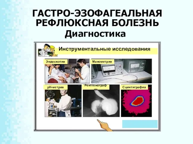 ГАСТРО-ЭЗОФАГЕАЛЬНАЯ РЕФЛЮКСНАЯ БОЛЕЗНЬ Инструментальные исследования Диагностика Эндоскопия Манометрия рН-метрия Рентгенография Сцинтиграфия