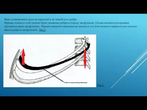 Врач устанавливает руки на передний и на задний угол ребра. Первым