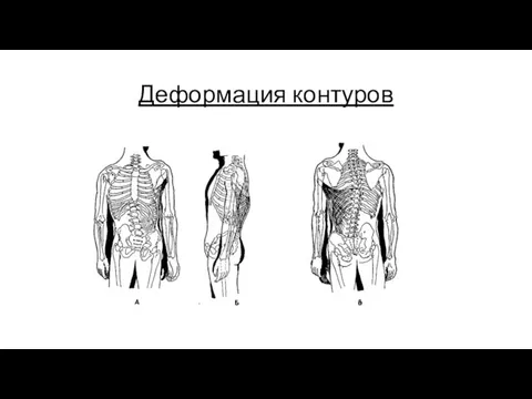 Деформация контуров