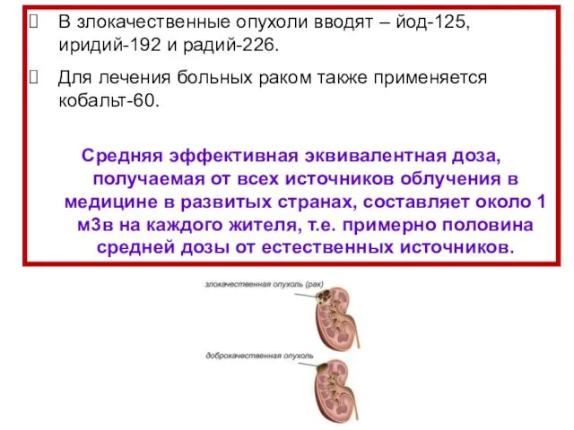 В злокачественные опухоли вводят – йод-125, иридий-192 и радий-226. Для лечения