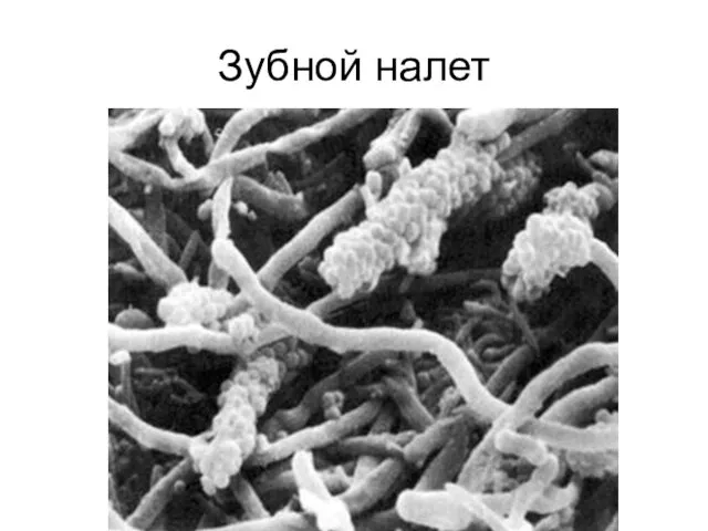 Зубной налет