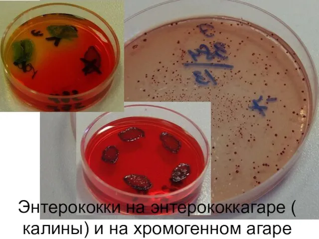 Энтерококки на энтерококкагаре ( калины) и на хромогенном агаре