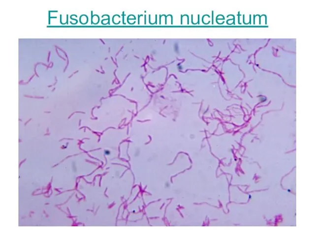 Fusobacterium nucleatum