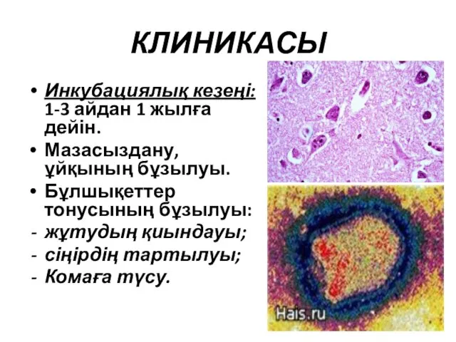 КЛИНИКАСЫ Инкубациялық кезеңі: 1-3 айдан 1 жылға дейін. Мазасыздану, ұйқының бұзылуы.