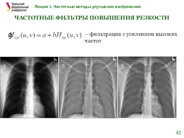 Лекция 5. Частотные методы улучшения изображений ЧАСТОТНЫЕ ФИЛЬТРЫ ПОВЫШЕНИЯ РЕЗКОСТИ —фильтрация с усилением высоких частот